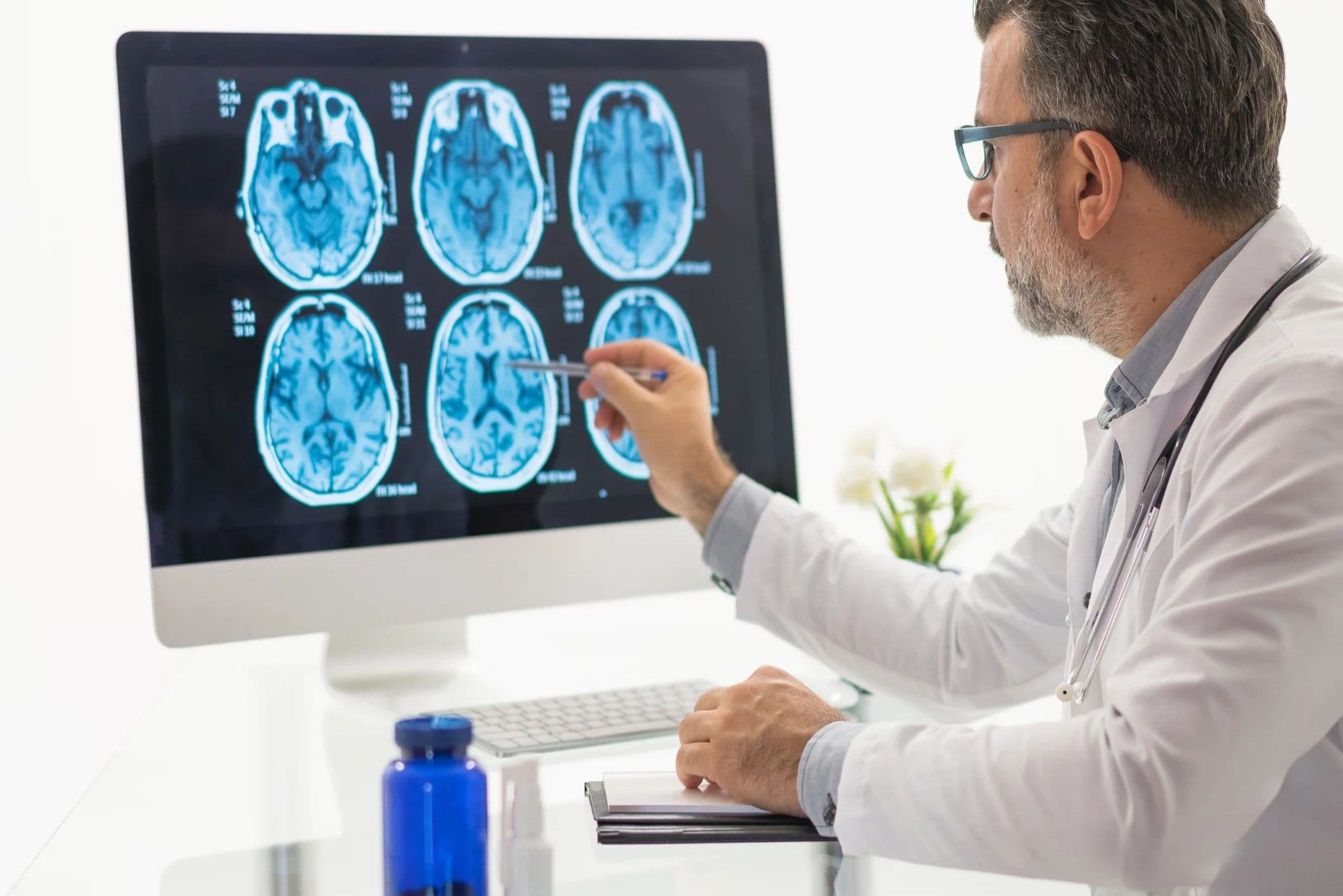 Cambios cerebrales del Alzheimer pueden iniciar desde los 50 años
