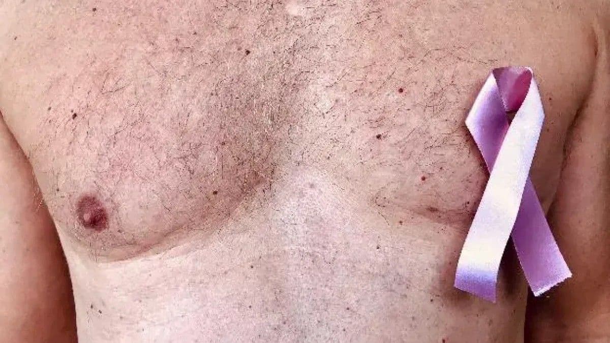 Cáncer de mama masculino: Riesgo y diagnóstico