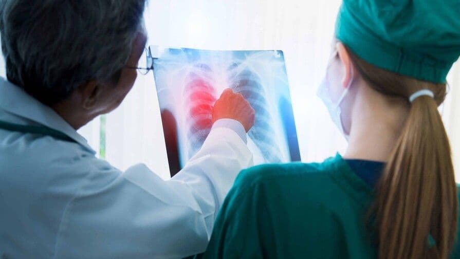 La detección temprana del cáncer pulmonar: un caso ejemplar