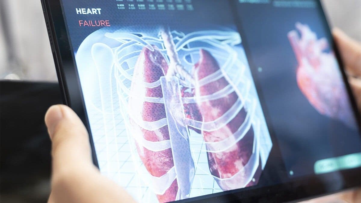 Pruebas genéticas transforman tratamiento de fibrosis pulmonar