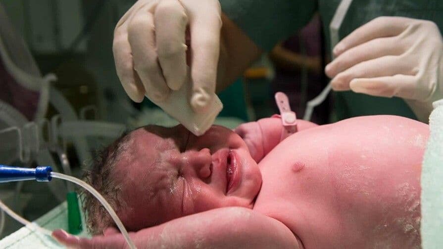 Parto vaginal y cesárea: Análisis de beneficios y riesgos en República Dominicana