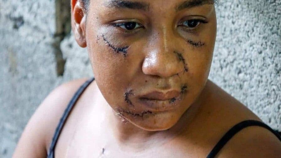 Nayely Altagracia Capellán sobrevive a brutal ataque